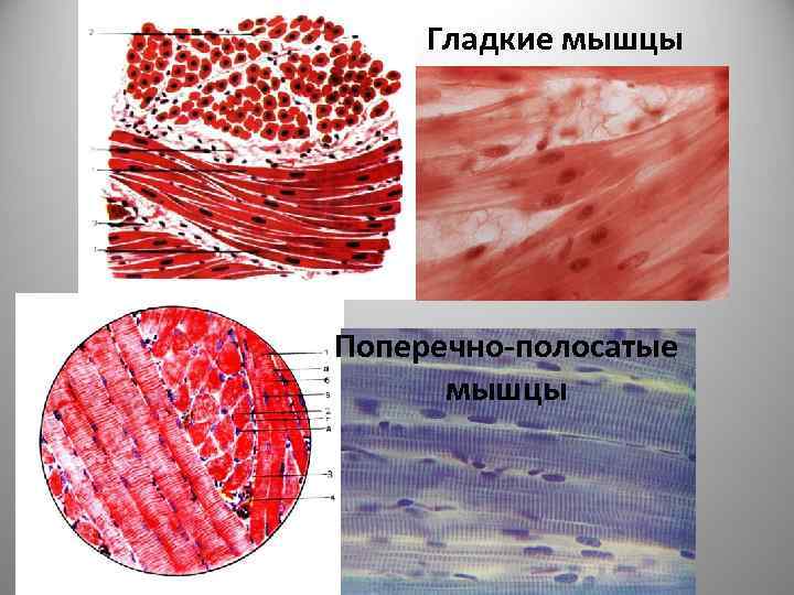 Где находятся поперечно полосатые мышцы