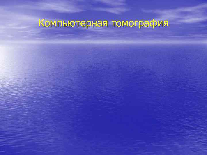Компьютерная томография 