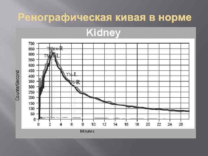 Ренографическая кивая в норме 