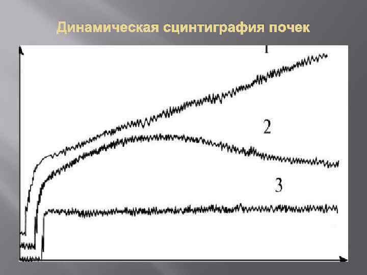 Динамическая сцинтиграфия почек 