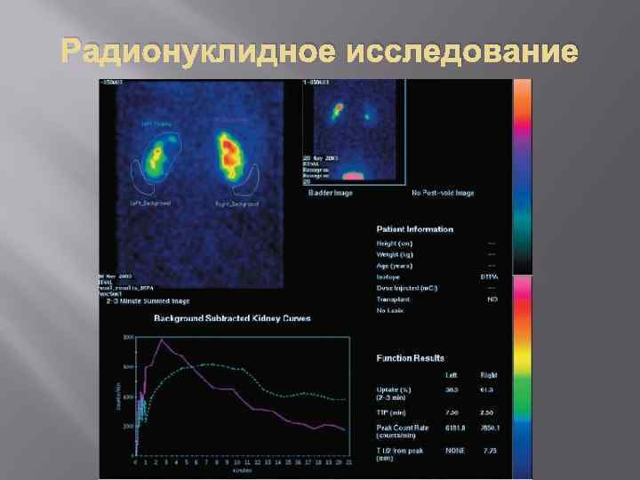 Радионуклидное исследование 