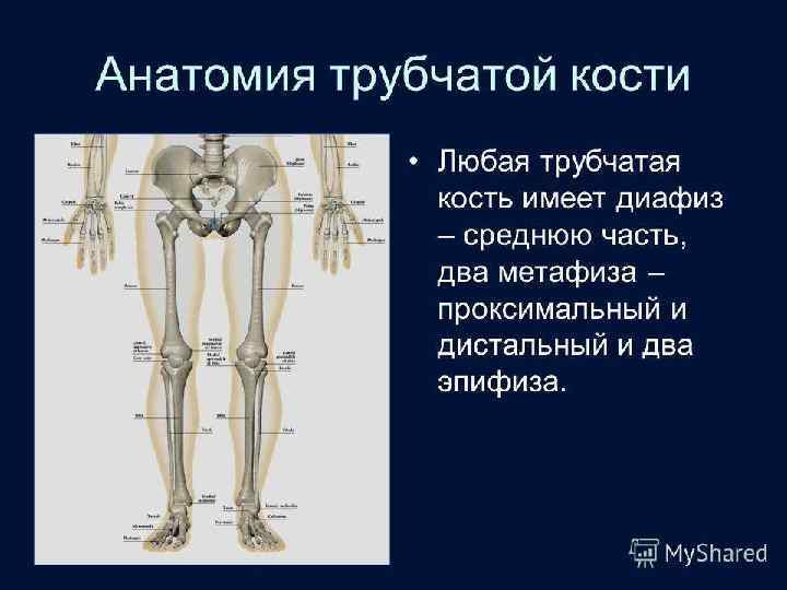 Рентгеновский аппарат передвижной 