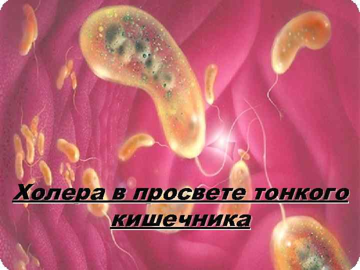 Холера в просвете тонкого кишечника 