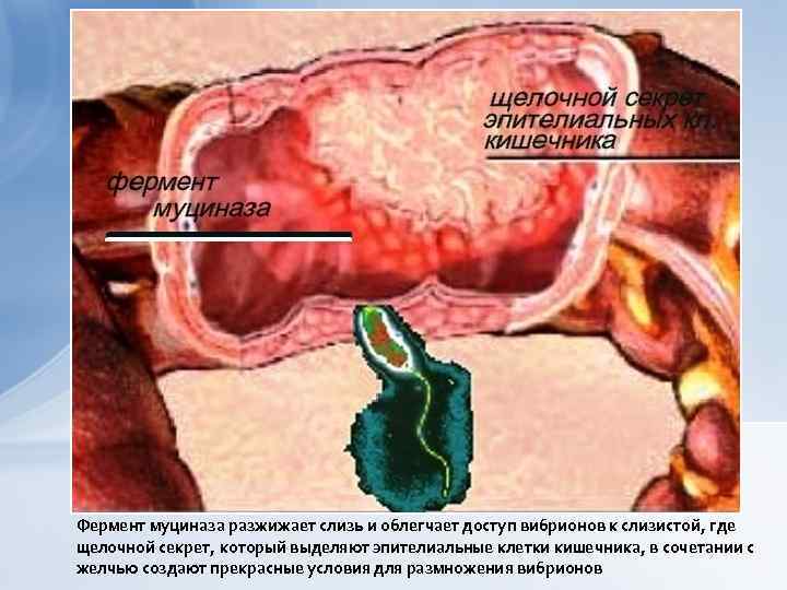 Фермент муциназа разжижает слизь и облегчает доступ вибрионов к слизистой, где щелочной секрет, который