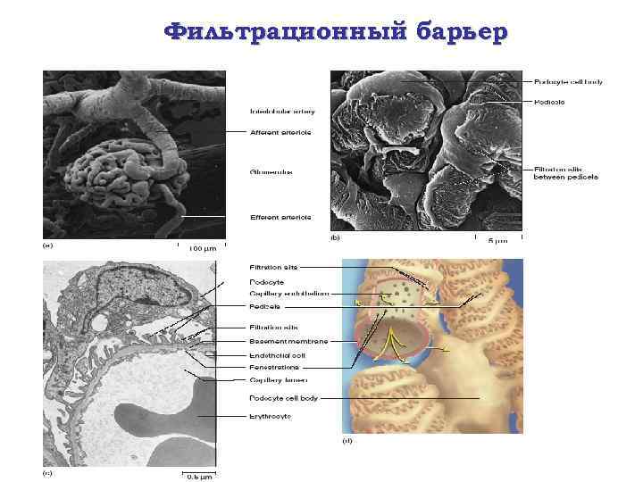 Фильтрационный барьер 