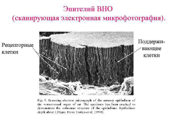 Эпителий ВНО (сканирующая электронная микрофотография). Рецепторные клетки Поддерживающие клетки 