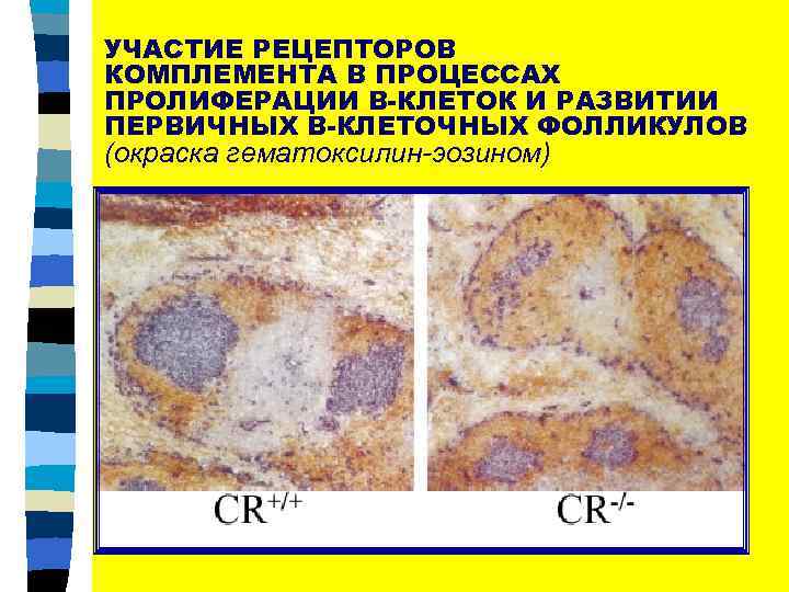 УЧАСТИЕ РЕЦЕПТОРОВ КОМПЛЕМЕНТА В ПРОЦЕССАХ ПРОЛИФЕРАЦИИ В-КЛЕТОК И РАЗВИТИИ ПЕРВИЧНЫХ В-КЛЕТОЧНЫХ ФОЛЛИКУЛОВ (окраска гематоксилин-эозином)