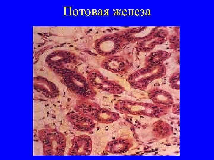 Потовая железа 