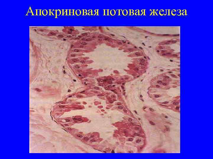 Апокриновая потовая железа 