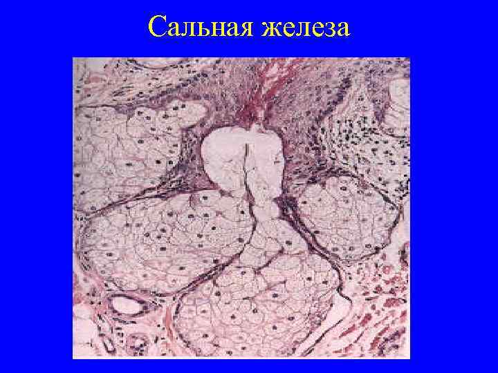 Сальная железа 