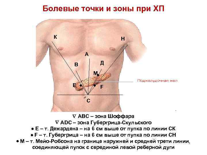 Болевые точки и зоны при ХП К Н А Д В М Е .