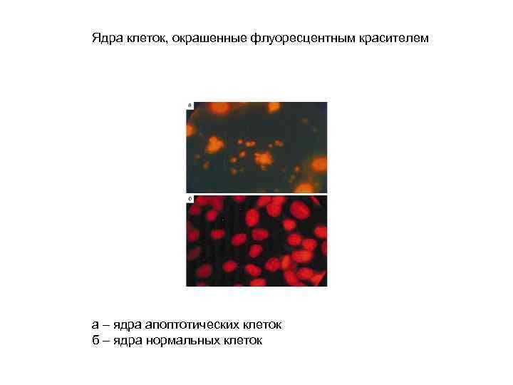 Ядра клеток, окрашенные флуоресцентным красителем а – ядра апоптотических клеток б – ядра нормальных