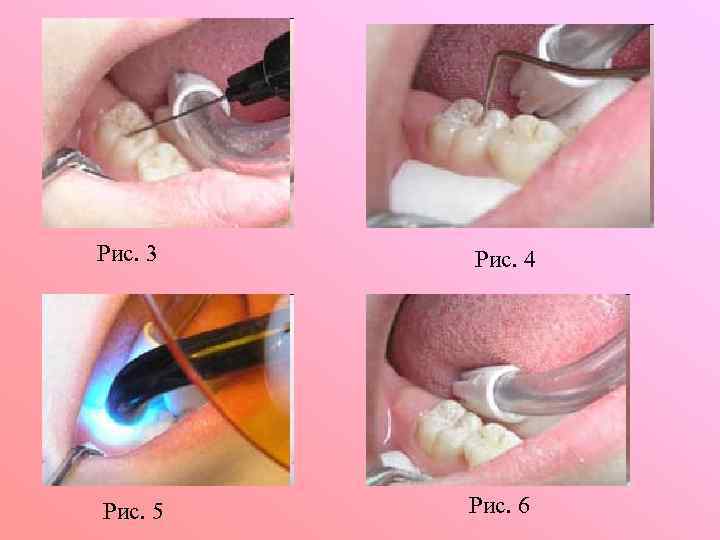 Рис. 3 Рис. 4 Рис. 5 Рис. 6 