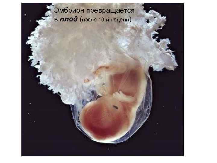 Эмбрион превращается в плод (после 10 -й недели) 
