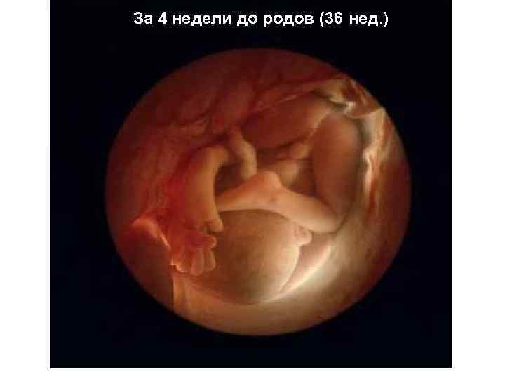 За 4 недели до родов (36 нед. ) 