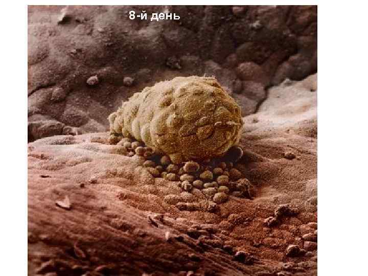 8 -й день 