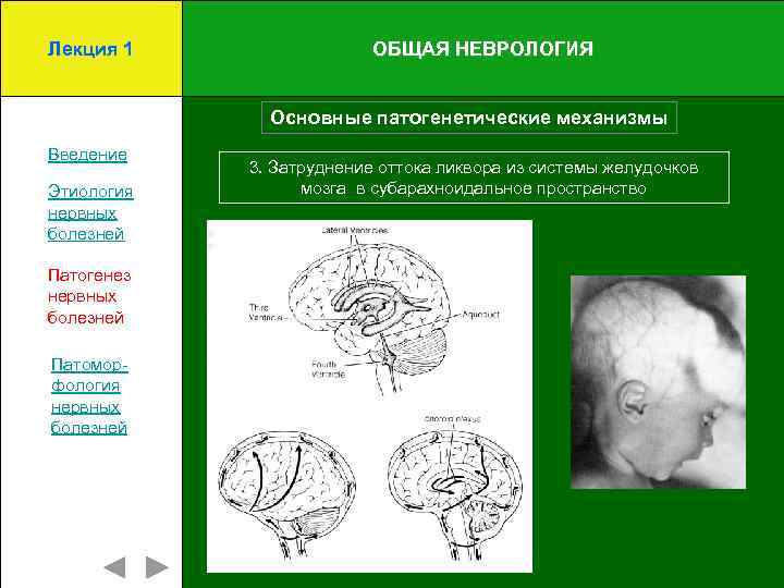 Лекция 1 ОБЩАЯ НЕВРОЛОГИЯ Основные патогенетические механизмы Введение Этиология нервных болезней Патогенез нервных болезней
