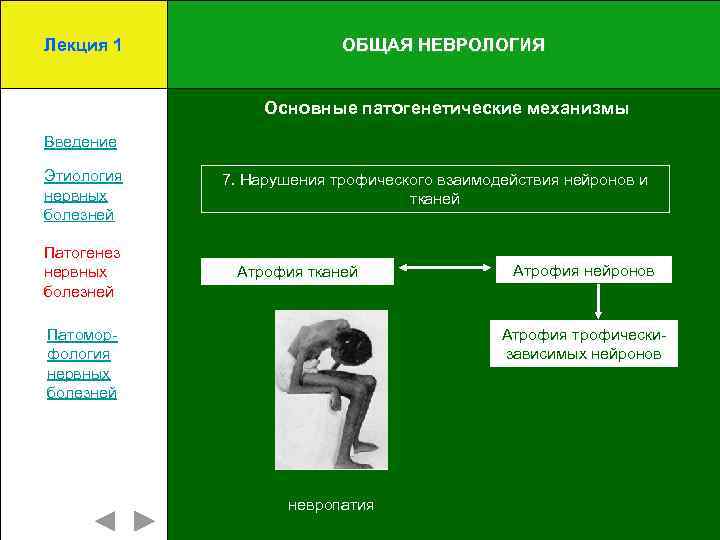 Лекция 1 ОБЩАЯ НЕВРОЛОГИЯ Основные патогенетические механизмы Введение Этиология нервных болезней Патогенез нервных болезней
