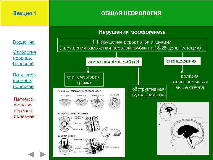 Лекция 1 ОБЩАЯ НЕВРОЛОГИЯ Нарушения морфогенеза Введение Этиология нервных болезней Патогенез нервных болезней Патоморфология