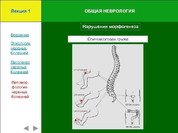 Лекция 1 ОБЩАЯ НЕВРОЛОГИЯ Нарушения морфогенеза Введение Этиология нервных болезней Патогенез нервных болезней Патоморфология