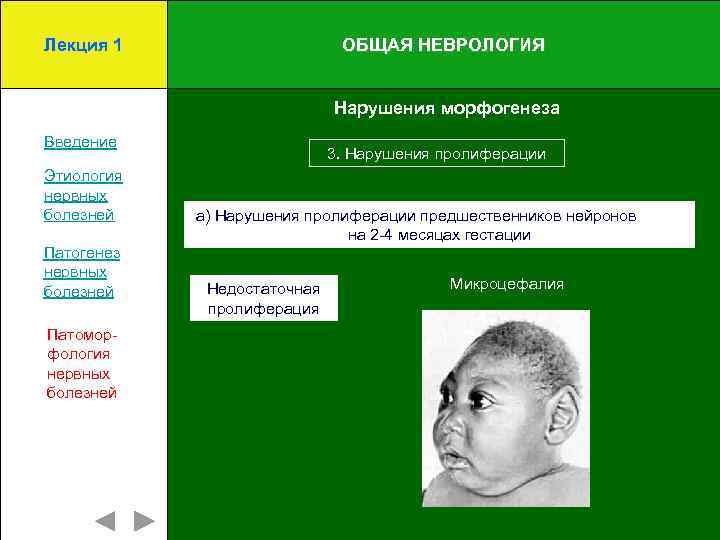 Лекция 1 ОБЩАЯ НЕВРОЛОГИЯ Нарушения морфогенеза Введение Этиология нервных болезней Патогенез нервных болезней Патоморфология