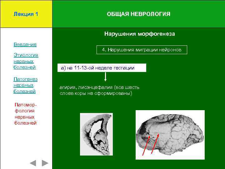 Патогенез нервных болезней