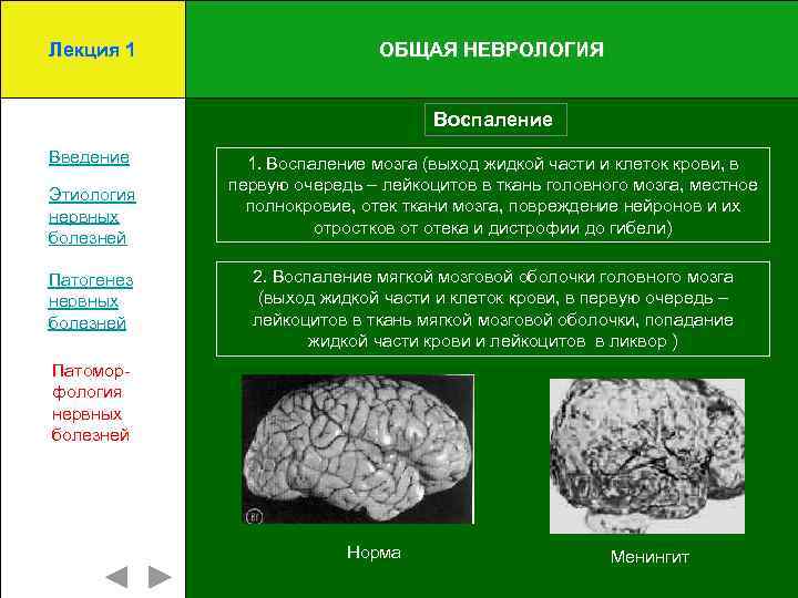 Лекция 1 ОБЩАЯ НЕВРОЛОГИЯ Воспаление Введение Этиология нервных болезней Патогенез нервных болезней 1. Воспаление