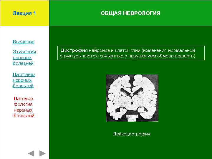 Лекция 1 ОБЩАЯ НЕВРОЛОГИЯ Введение Этиология нервных болезней Дистрофия нейронов и клеток глии (изменения