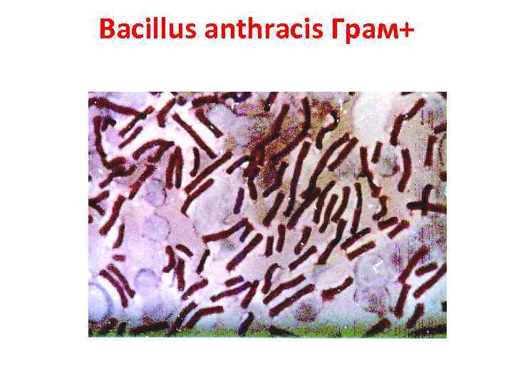 Bacillus anthracis Грам+ 
