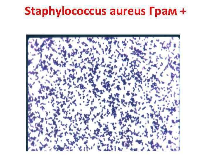 Staphylococcus aureus Грам + 