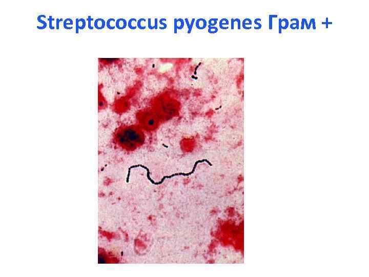 Streptococcus pyogenes Грам + 
