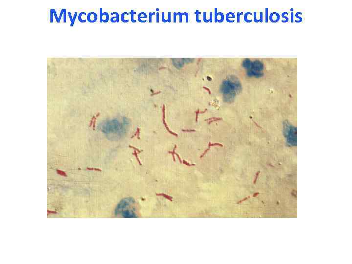 Mycobacterium tuberculosis 