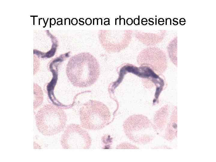 Trypanosoma rhodesiense 