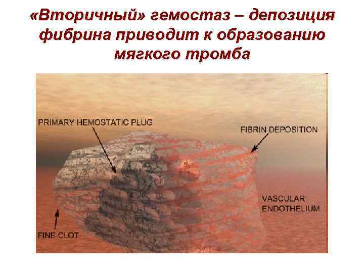  «Вторичный» гемостаз – депозиция фибрина приводит к образованию мягкого тромба 