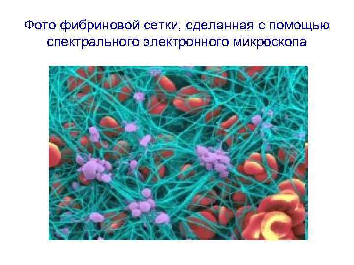 Фото фибриновой сетки, сделанная с помощью спектрального электронного микроскопа 