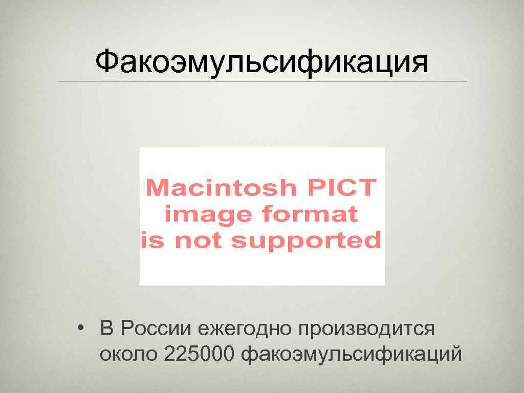 Факоэмульсификация • В России ежегодно производится около 225000 факоэмульсификаций 