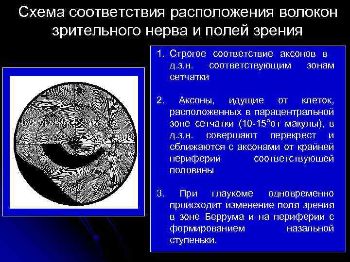 Схема соответствия расположения волокон зрительного нерва и полей зрения 1. Строгое соответствие аксонов в