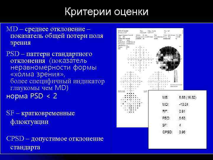  Критерии оценки MD – среднее отклонение – показатель общей потери поля зрения PSD