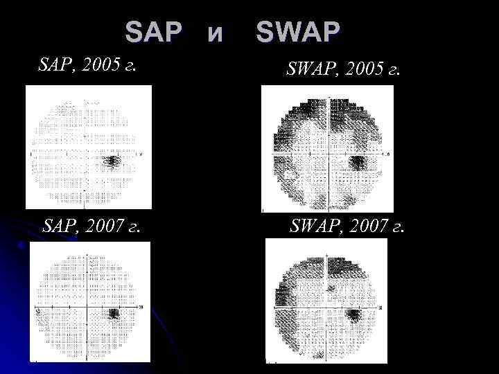 SAP и SWAP SAP, 2005 г. SWAP, 2005 г. SAP, 2007 г. SWAP, 2007