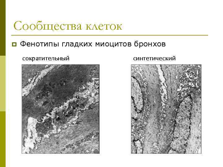 Сообщества клеток p Фенотипы гладких миоцитов бронхов сократительный синтетический 