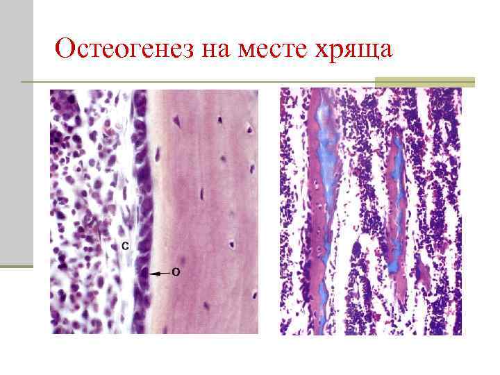 Остеогенез на месте хряща 