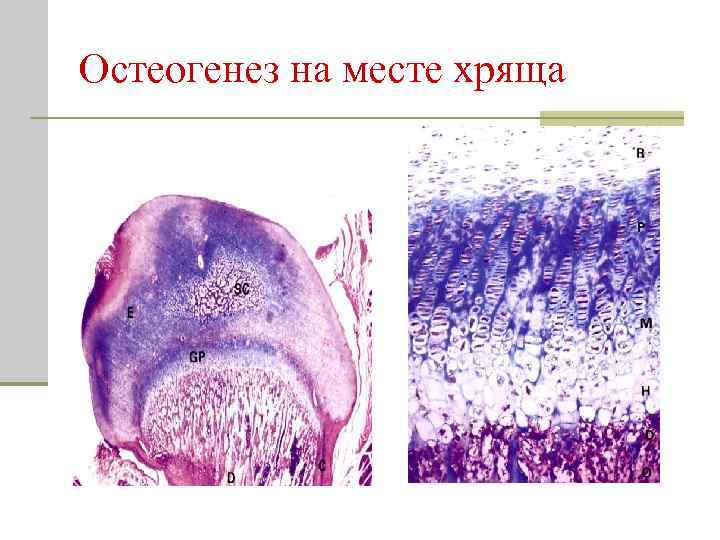 Остеогенез на месте хряща 