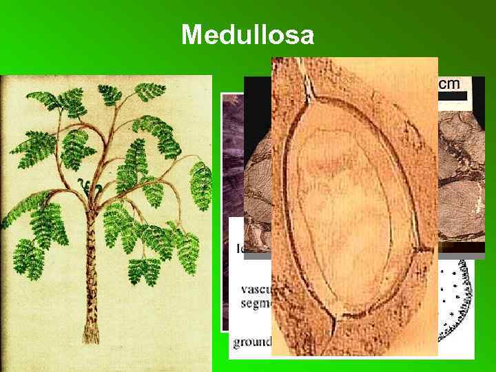 Medullosa 