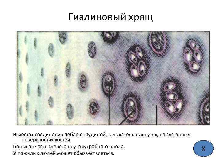 Гиалиновый хрящ В местах соединения ребер с грудиной, в дыхательных путях, на суставных поверхностях