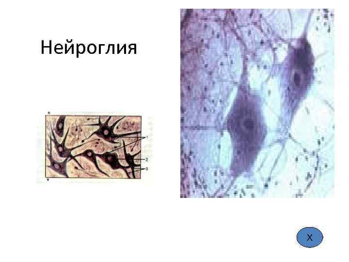 Нейроглия Х 