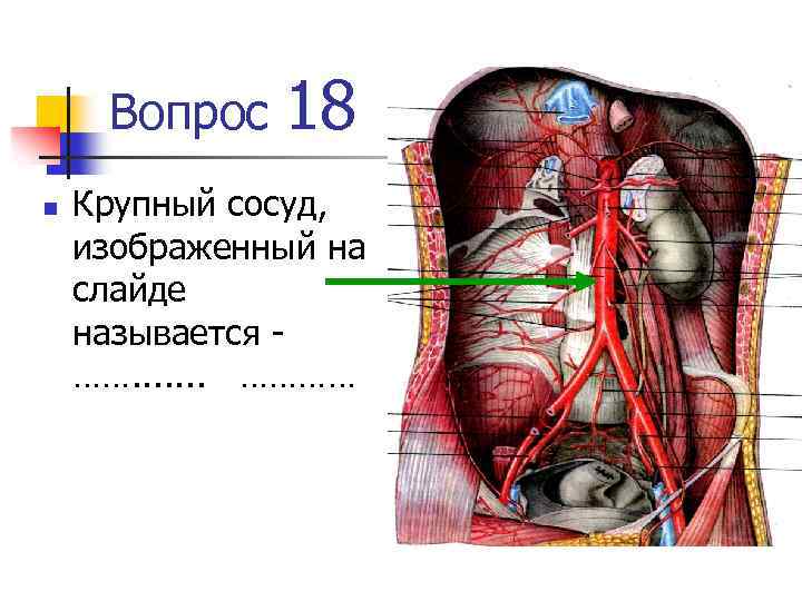 Сосуд изображенный