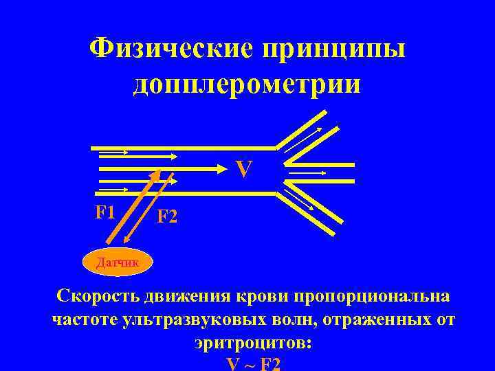 Физические принципы допплерометрии V F 1 F 2 Датчик Cкорость движения крови пропорциональна частоте