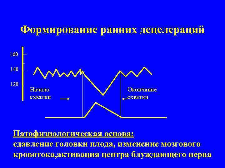 Формирование ранних децелераций 160 140 120 Начало схватки Окончание схватки Патофизиологическая основа: сдавление головки