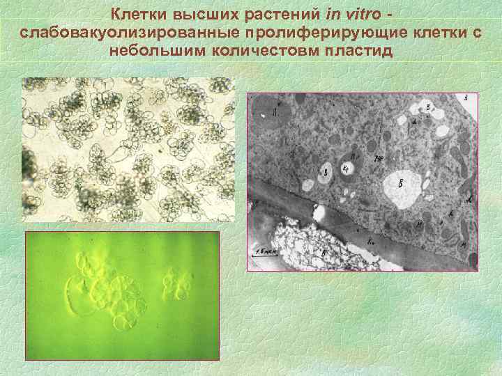 Клетки высших растений in vitro слабовакуолизированные пролиферирующие клетки с небольшим количестовм пластид 