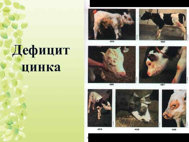 Дефицит цинка 